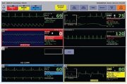 Центральная станция мониторирования GE Healthcare