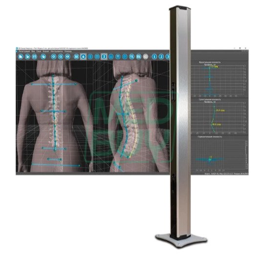 Бодисканер 3D БИОКИНЕКТ Неврокор _0