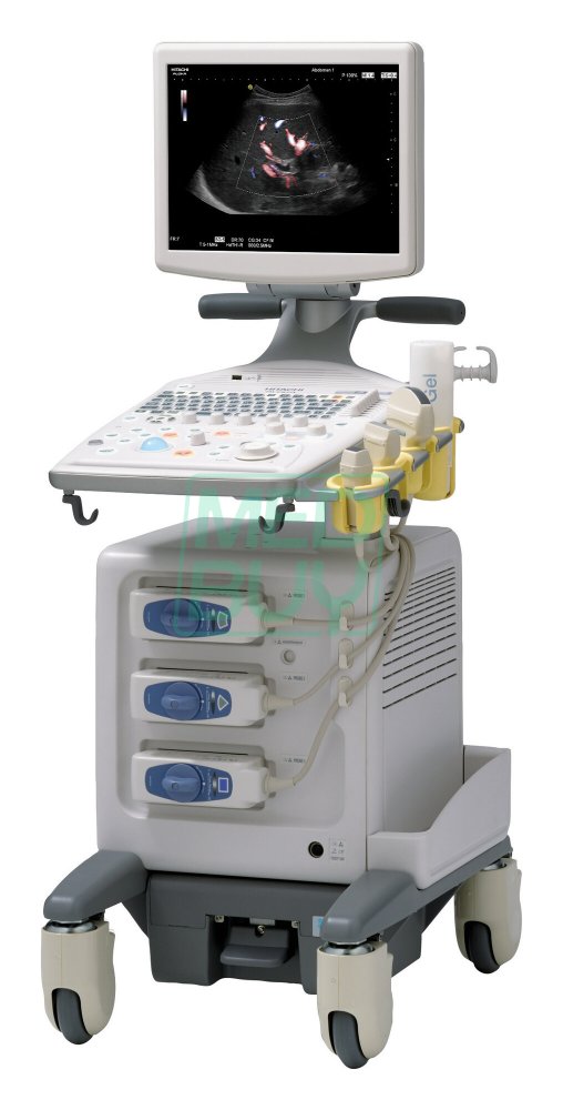 УЗИ-аппарат Hitachi Aloka F31