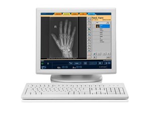 Цифровая рентгенографическая система PrimaryDiagnost DR Philips