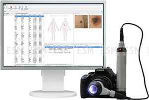 Цифровое решение Vision Derma Basic _1