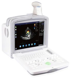 Переносной ультразвуковой сканер с цветным доплером RS880i AcuVista _1