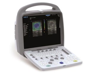 Портативный аппарат УЗИ CTS 7700 SIUI _1