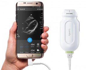 Портативный УЗ аппарат Lumify Philips