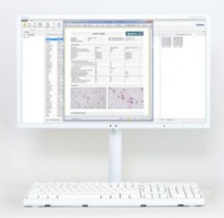 Система организации исследований качества спермы SQA® PC Vision _1