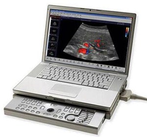 Ультразвуковой сканер Prosound C3 Hitachi Aloka _1