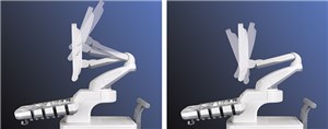 Ультразвуковой сканер SSI-6000 SonoScape _1