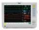 Прикроватный монитор пациента Vista 120 Drager _0