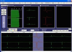 Аппарат холтера HolterCare1 Software ScottCare