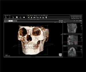 Дентальный компьютерный томограф Papaya 3D Genoray