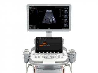 Ультразвуковая система Siemens ACUSON Redwood