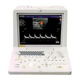 Ультразвуковой сканер SonoScape SSI-1000